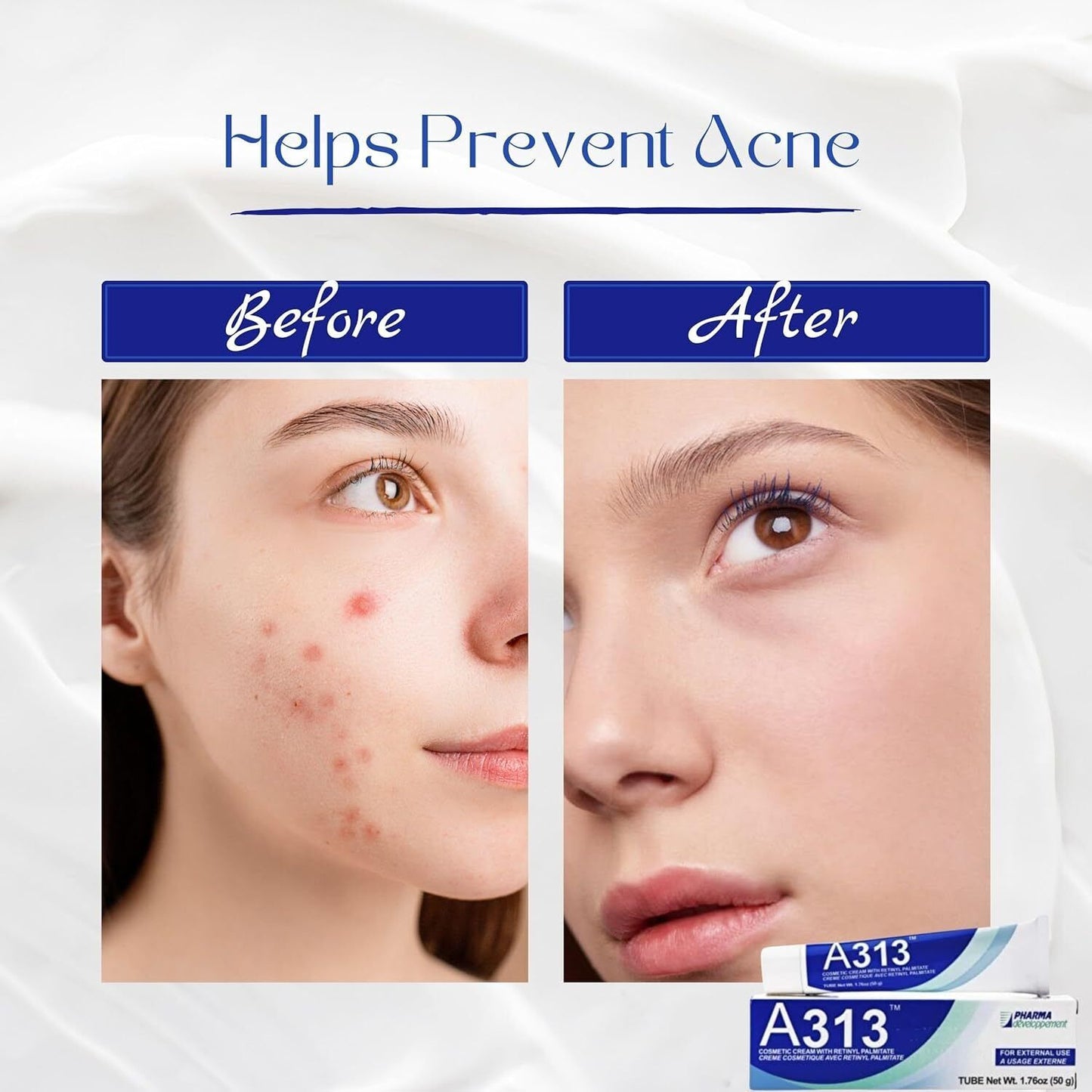 A313 Retinol Pommade Anti Aging Night Cream and the pore cleansing skin cream